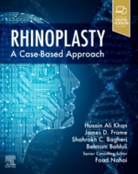 Rhinoplasty: a Case-based approach 1ed e-book (ISBN: 9780323697767)