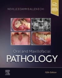 Oral and Maxillofacial Pathology: 5ed (ISBN: 9780323789813)