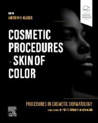 Procedures in Cosmetic Dermatology: Cosmetic Procedures in Skin of Color: 1ed (ISBN: 9780323831444)