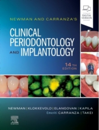 Newman and Carranza's Clinical Periodontology and Implantology: 14ed e-book (ISBN: 9780323878883) Newman and Carranza's Clinical Periodontology and Implantology: 14ed e-book (ISBN: 9780323878883)