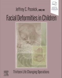 Facial Deformities in Children: Thirteen Life Changing Operations 1ed (ISBN: 9780323932394)