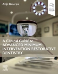 A Clinical Guide to Advanced Minimum Intervention Restorative Dentistry: 1ed (ISBN: 9780443109713)