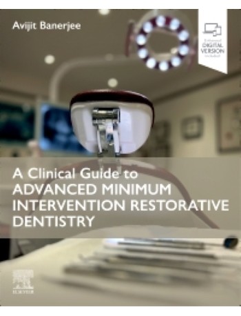 A Clinical Guide to Advanced Minimum Intervention Restorative Dentistry: 1ed e-book (ISBN: 9780443110580)